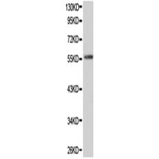  兔抗RAD9A多克隆抗体  