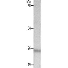兔抗TK1(Ab-13)多克隆抗体
