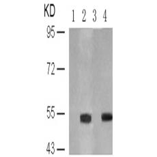兔抗TP53 (Phospho-Ser6)多克隆抗体