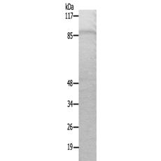 兔抗TACC1多克隆抗体