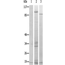 兔抗MRPL14多克隆抗体