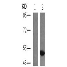 兔抗MAPT (Phospho-Ser404)多克隆抗体