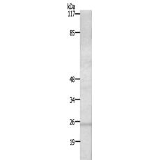 兔抗RIT1多克隆抗体 