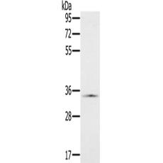 兔抗NDUFA9多克隆抗体