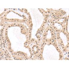  兔抗RPS6KA5多克隆抗体  
