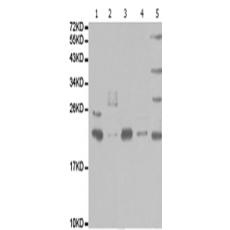 兔抗PSMB9多克隆抗体