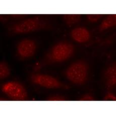 兔抗PRKCB (Phospho-Thr641)多克隆抗体