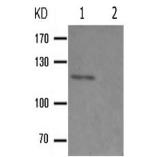 兔抗PTK2(Phospho-Ser843)多克隆抗体