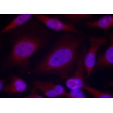 兔抗MAPK8 MAPK9 MAPK10(phospho-Thr183 Tyr185)多克隆抗体