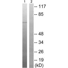 兔抗OXSR1(Phospho-Thr185)多克隆抗体