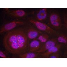 兔抗RELA (Phospho-Ser276) 多克隆抗体  