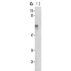 兔抗RELA (Phospho-Ser276) 多克隆抗体  