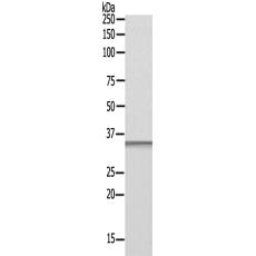 兔抗PITX1多克隆抗体