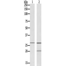 兔抗PRRX1多克隆抗体