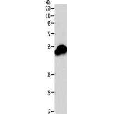  兔抗SIRT6多克隆抗体 