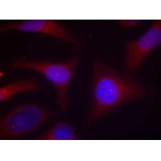兔抗NFKBIA (Phospho-Ser32 Ser36)多克隆抗体