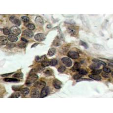 兔抗NFKBIA (Phospho-Ser32 Ser36)多克隆抗体