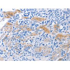 兔抗NECTIN1多克隆抗体