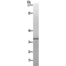 兔抗PEX14多克隆抗体