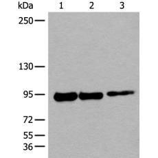 兔抗PIBF1多克隆抗体