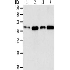 兔抗TGM2多克隆抗体   