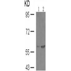 兔抗SMAD2 (Phospho-Ser467)多克隆抗体 