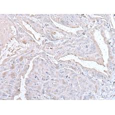 兔抗PTP4A1多克隆抗体