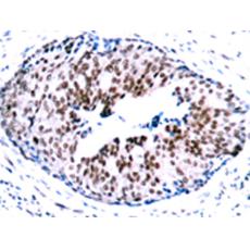 兔抗STAT5A (Phospho-Ser780) 多克隆抗体  