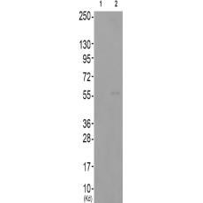 兔抗SYT1(Phospho-Thr202) 多克隆抗体  