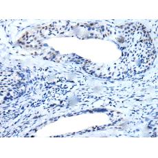 兔抗TMPRSS6多克隆抗体 