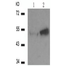 兔抗TP53 (Phospho-Ser46)多克隆抗体