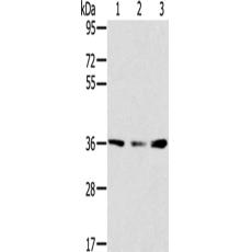 兔抗SMN1多克隆抗体  