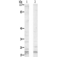 兔抗TRAPPC3多克隆抗体