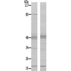 兔抗SNCA(Ab-125) 多克隆抗体 