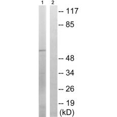  兔抗STK39(Phospho-Ser311) 多克隆抗体 