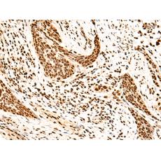  兔抗SNRPB2多克隆抗体    