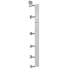 兔抗TCF4/12多克隆抗体 