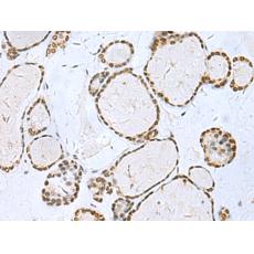 兔抗TH多克隆抗体 