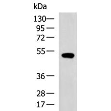 兔抗SLC29A2多克隆抗体   