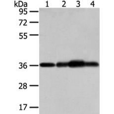 兔抗STX12多克隆抗体  