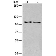 兔抗TMEM67多克隆抗体 