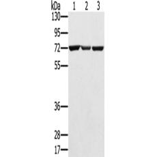  兔抗SLC25A13多克隆抗体   
