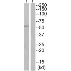 兔抗TPH2(Phospho-Ser19) 多克隆抗体 