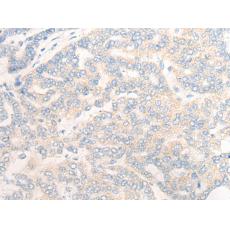  兔抗SLC28A2多克隆抗体  