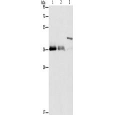  兔抗TNFSF13B多克隆抗体   