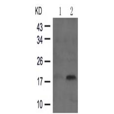 兔抗STMN1 (Phospho-Ser16)多克隆抗体