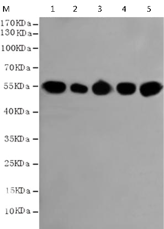 小鼠抗TUBB(HRP-Conjugate)单克隆抗体