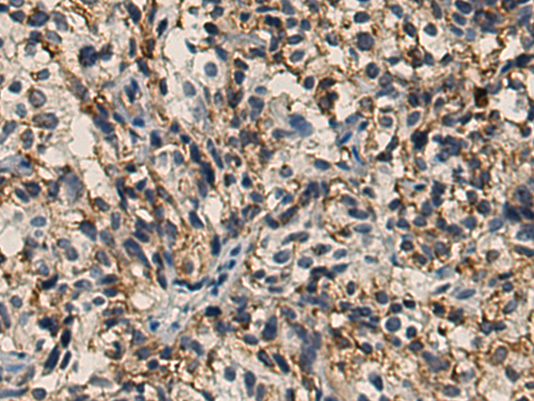  小鼠抗TUBB3单克隆抗体 