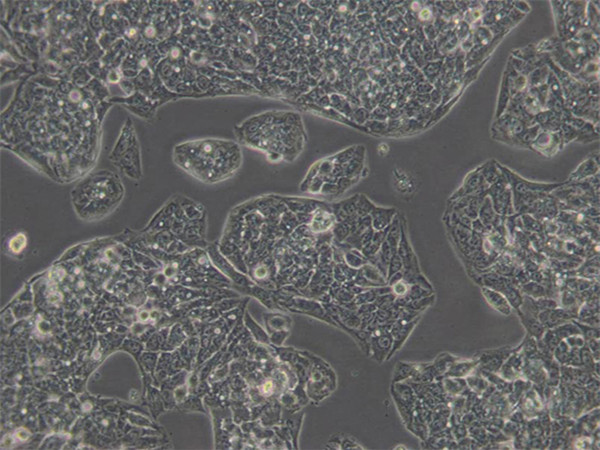 大鼠骨髓瘤细胞