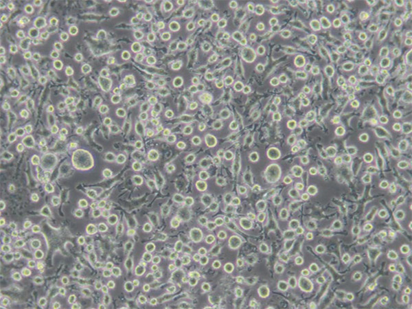 小鼠杂交瘤细胞(抗CD2)
